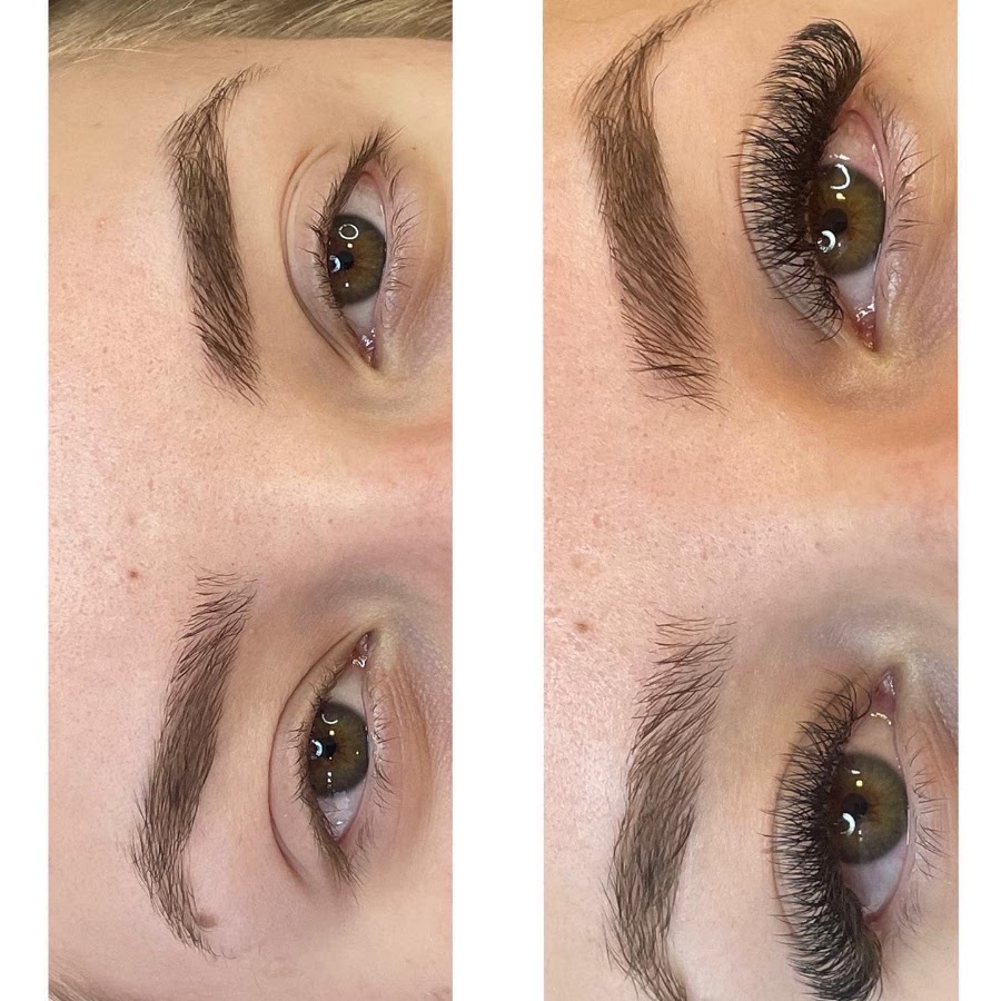 Antes e depois de extensão volume